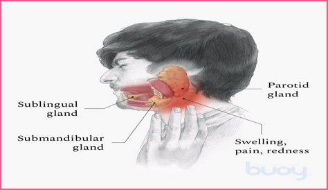 Why do my glands swell after eating?